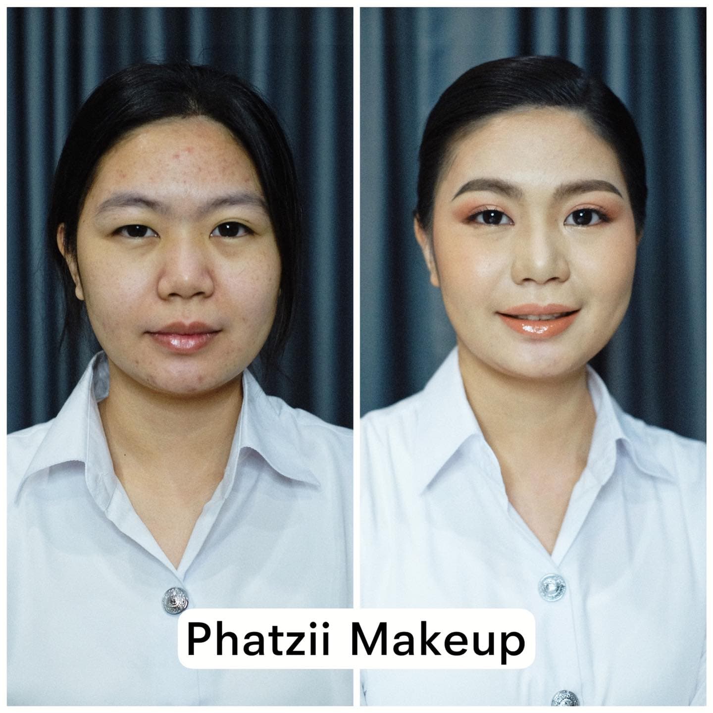 🔥 Before - After 🔥