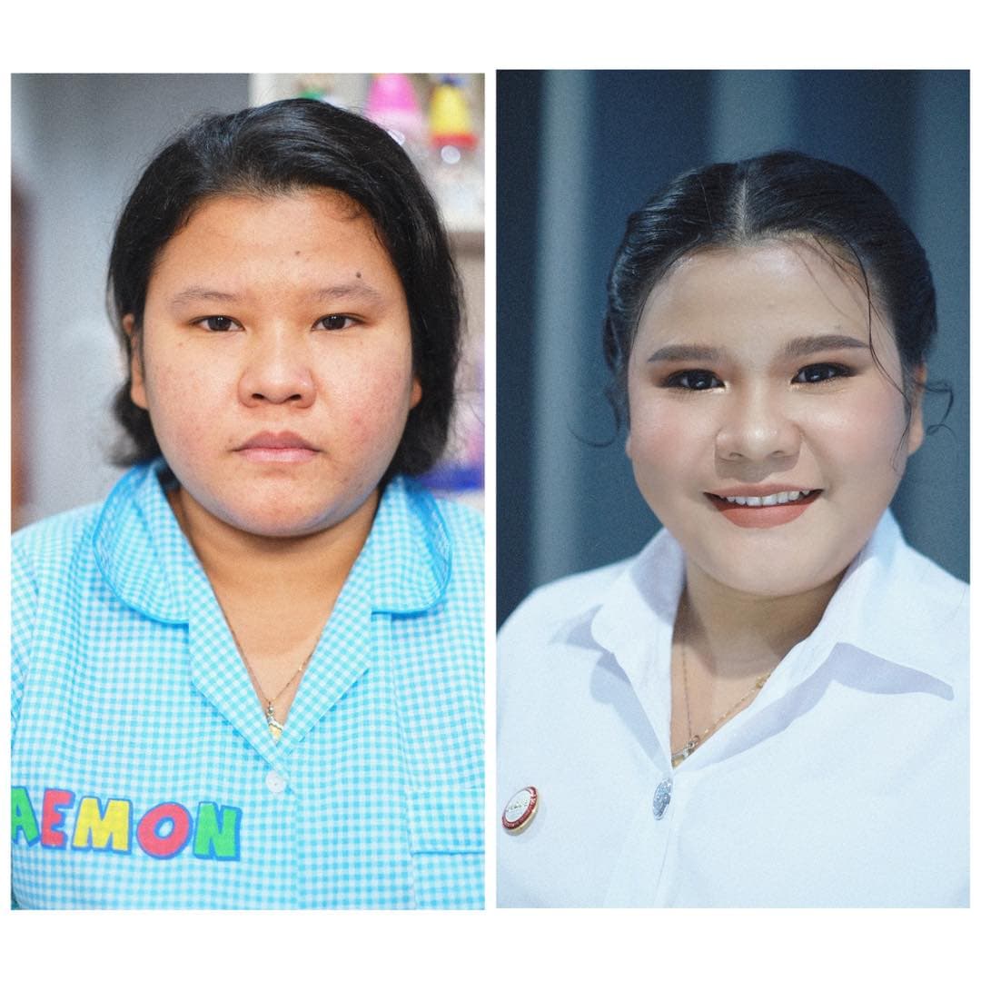 Before-After น้องฝน คนงาม ม.กรุงเทพธนบุรี🎓