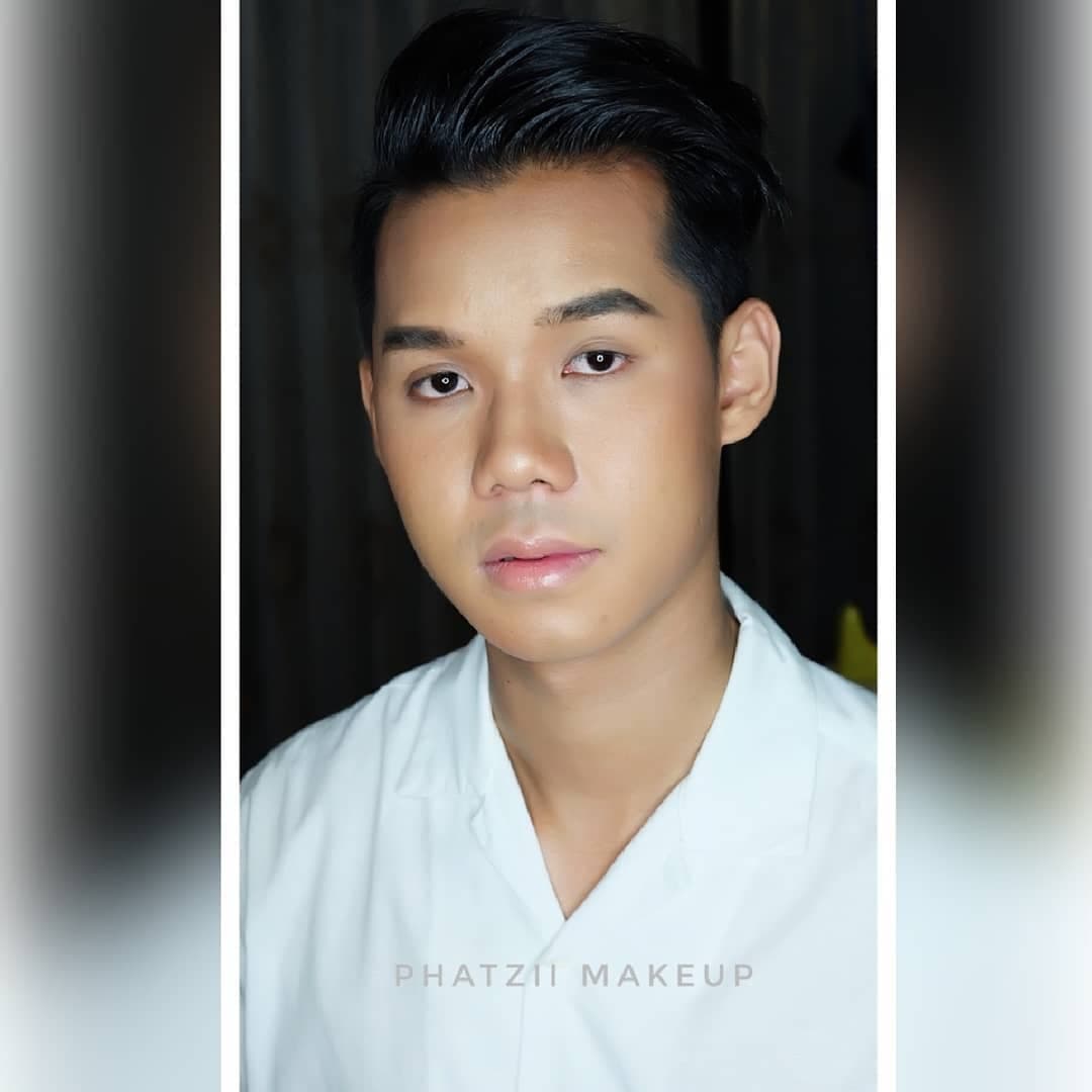ภาพ Before-After น้องนนท์